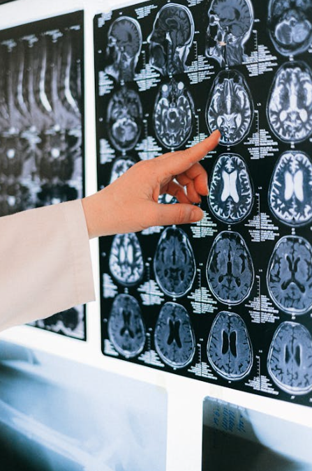 Does an MRI Increase a Settlement Amount?